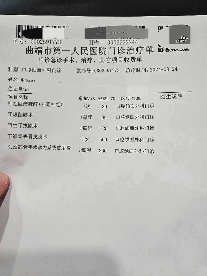 阻生牙拔除多少钱_2
