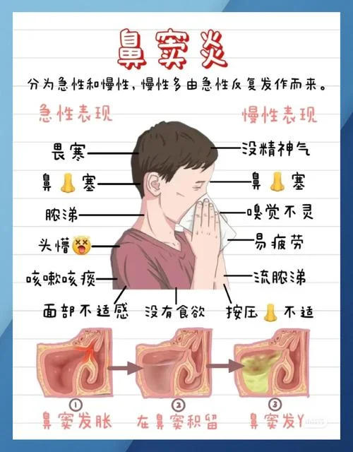 鹰钩鼻怎么办_1