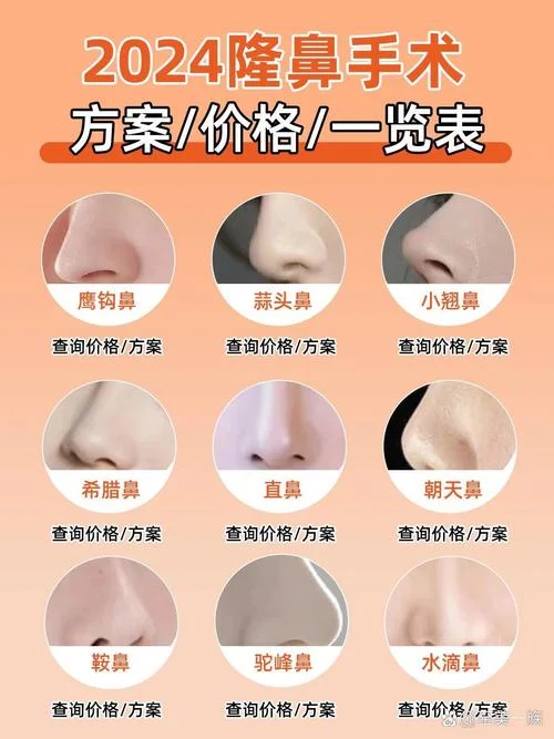 隆鼻手术的费用是多少钱_2