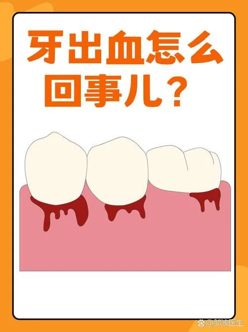 梦到自己牙龈出血吐血_1
