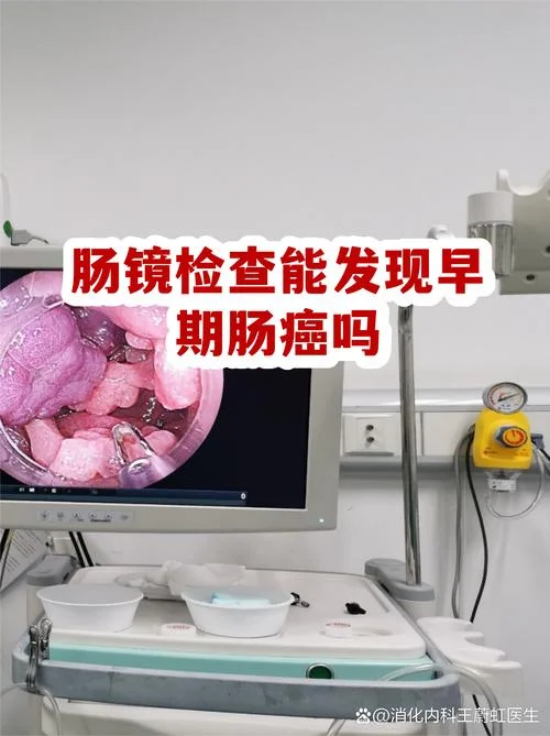 如何做肠镜肠癌筛查_2