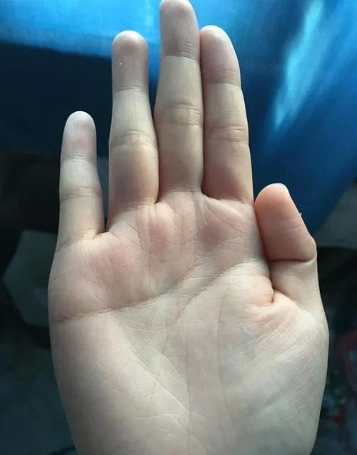 大拇指指纹手相夫子眼-拇指指纹指相夫子眼