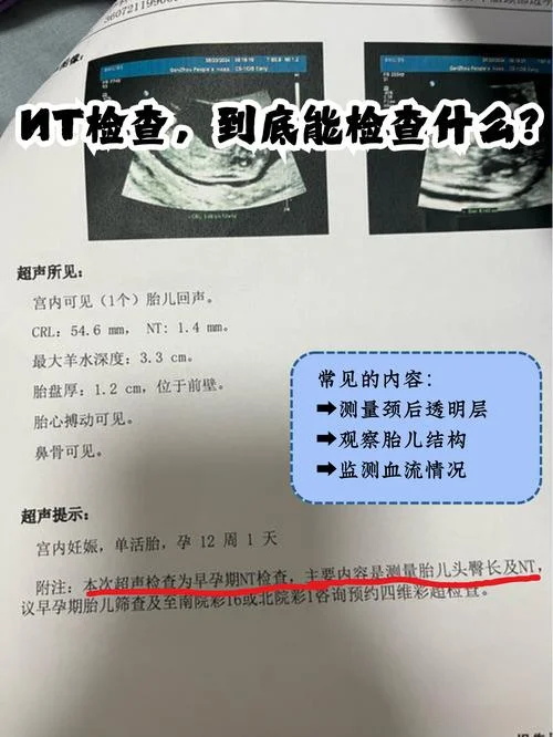 怀孕nt检查是查什么_2