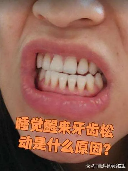 梦到大量牙齿松动_2