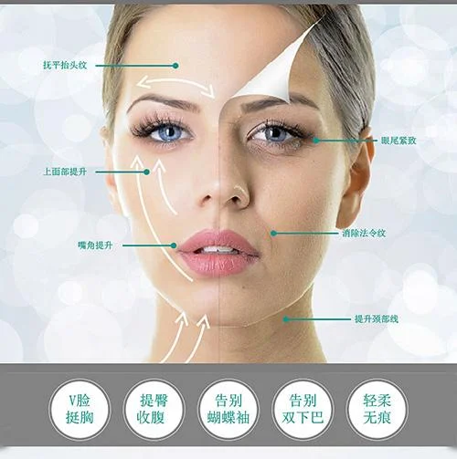 雷达线雕多少钱一次_1