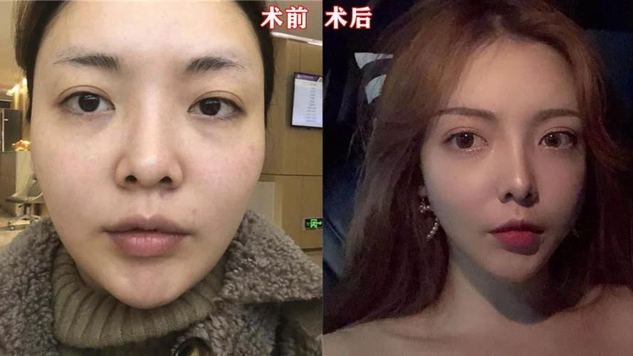 磨骨多少钱黄大勇_2