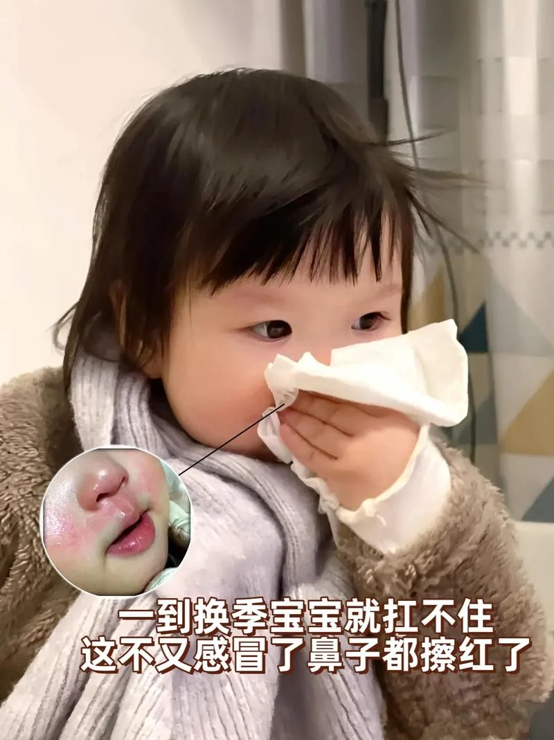新生儿有点流鼻涕怎么办_1