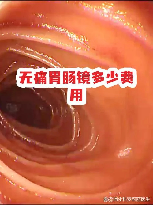查一下胃镜需要多少钱_1