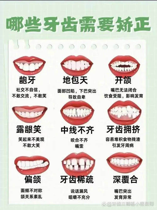 什么人牙什么_1