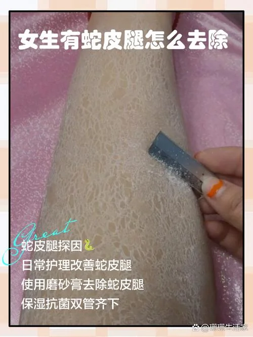梦见蛇皮是什么预兆_1