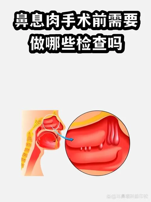 鼻镜检查怎么做-鼻镜检查怎么做