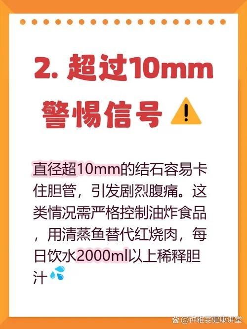 胆囊结石7mm需要多少钱_1