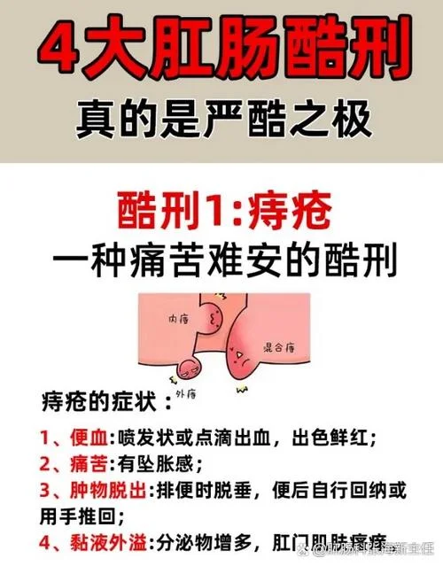 肛门口肿胀疼痛怎么办_1