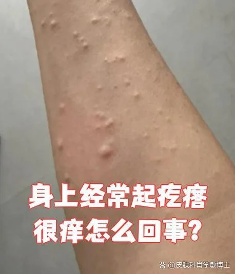 梦见自己身上长疙瘩_1