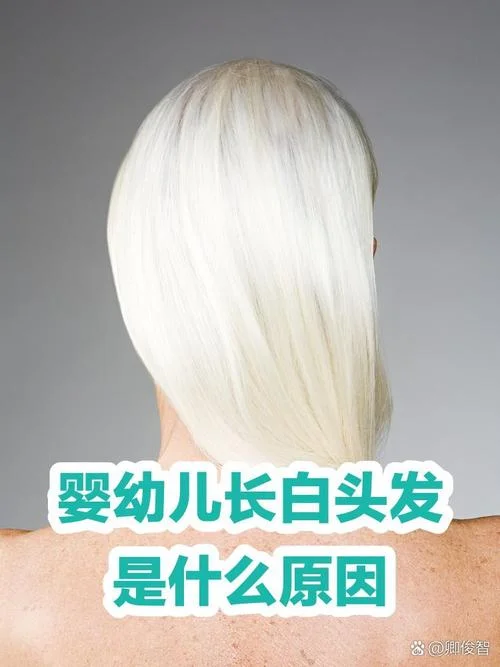 梦见自己有白头发了_2