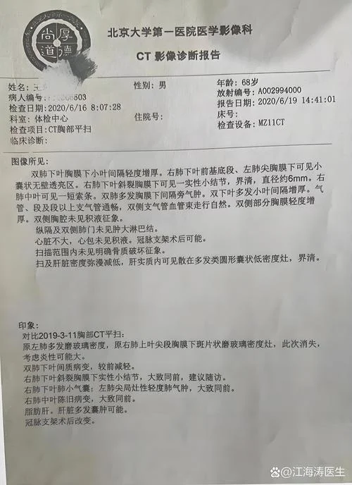 肺大泡检查什么项目_2