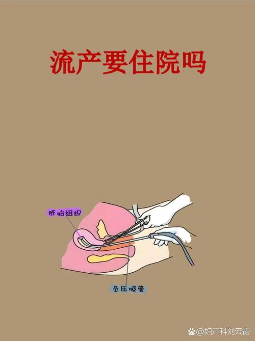 梦到自己怀孕流产-梦见怀孕后流产