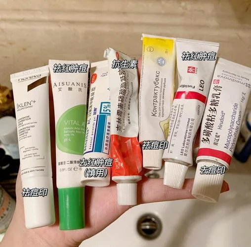 药店买什么祛痘_2