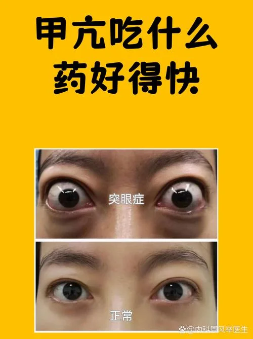 甲亢药多少钱一盒_1