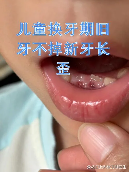 梦见牙齿脱落长出新牙_1