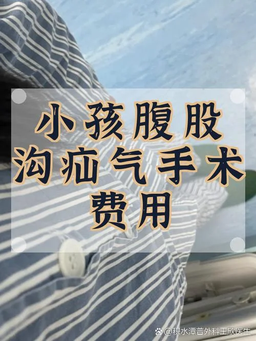 疝气手术费多少钱?_1