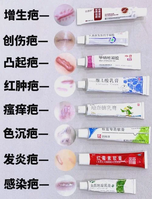 疤痕膏哪个品牌好_1
