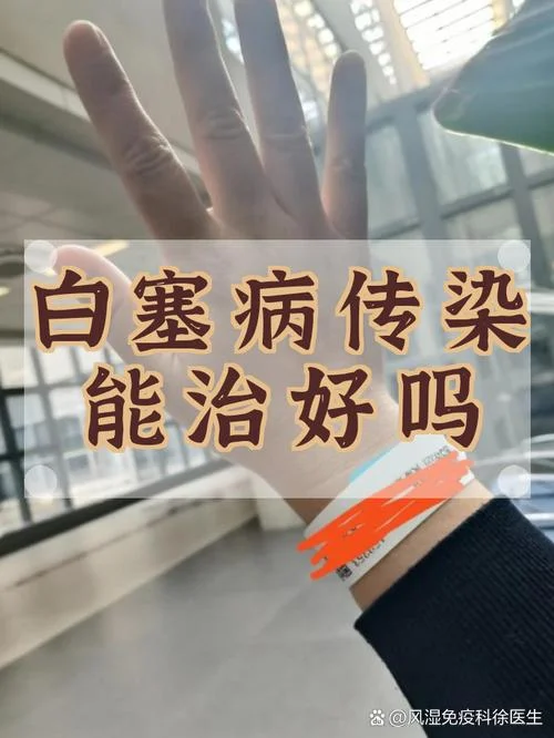如何查白塞病_1