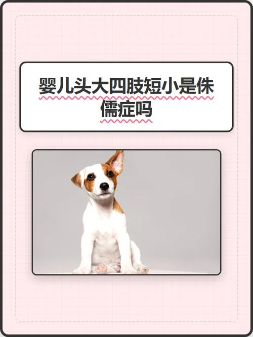 什么是四肢短小症-