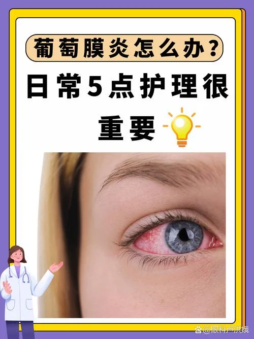 美瞳感染了怎么办_1