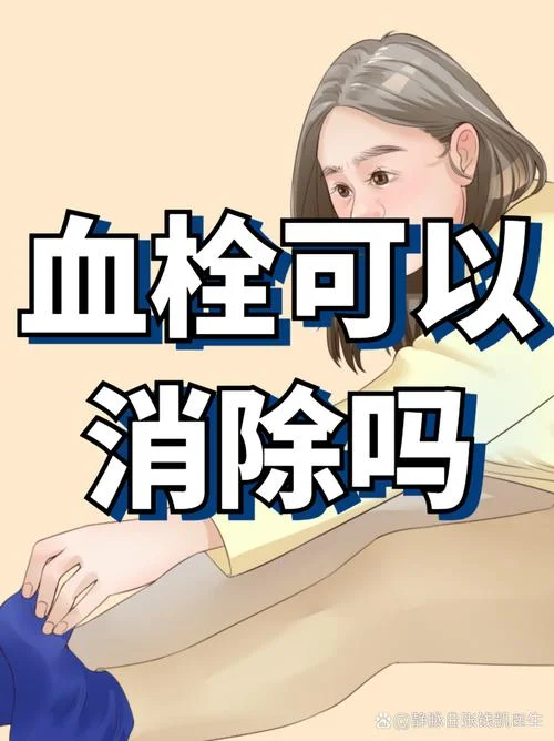 梦到血栓_2