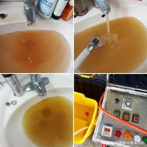 管之净设备多少钱一台_2