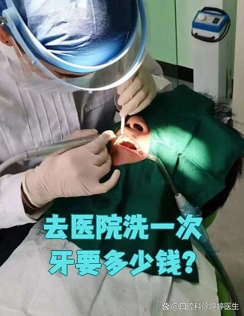 洗牙好不好多少钱_1