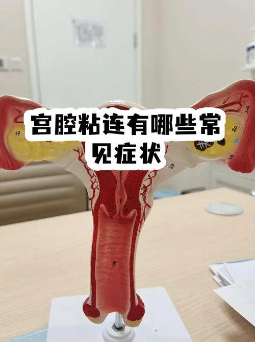 什么临床症状是月经紊乱-月经紊乱临床症状