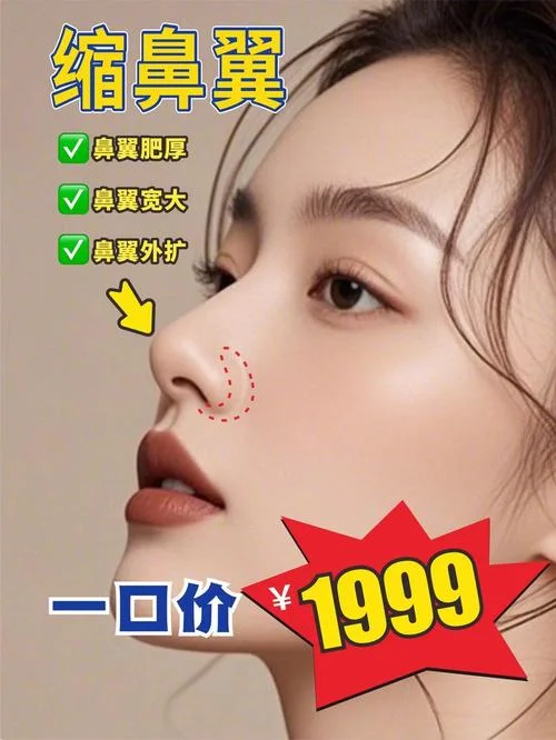 缩鼻头多少钱_1