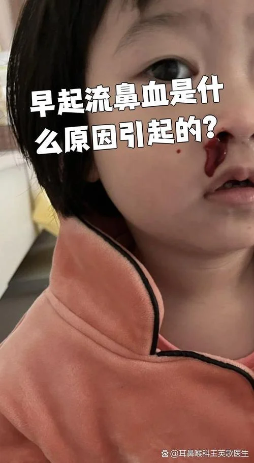 别人梦见流鼻血_2