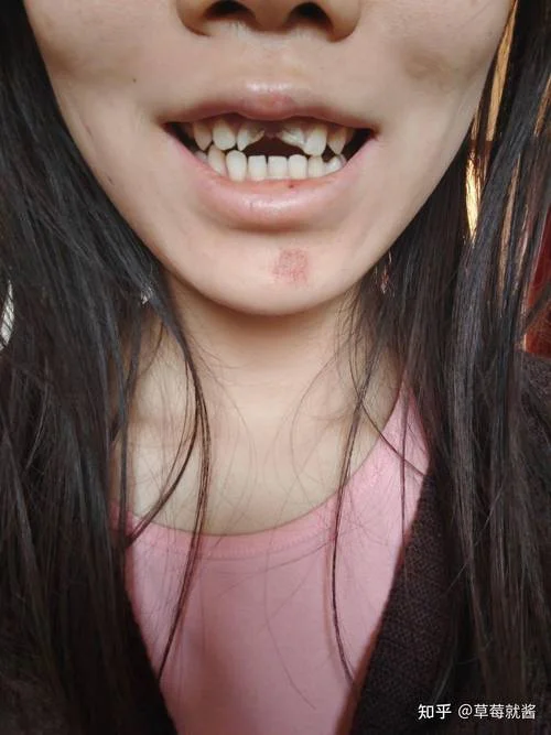 女人梦见门牙掉了一颗_1