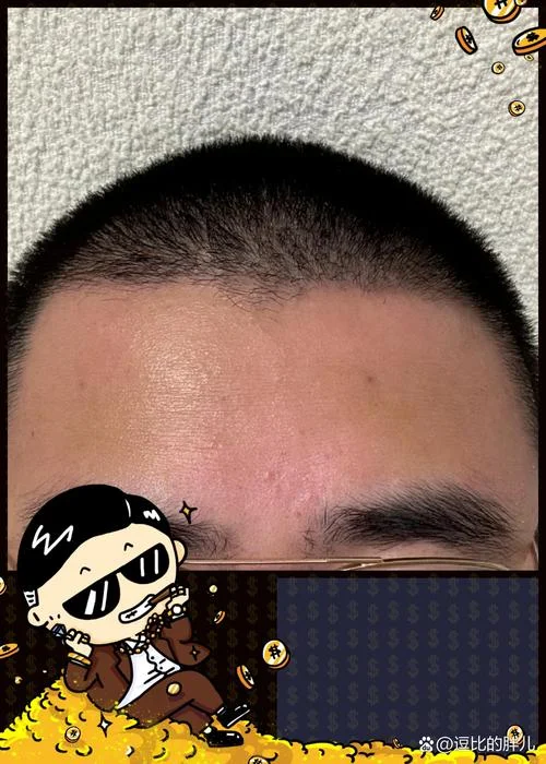梦见老婆印堂发黑_2