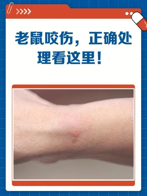 梦见白色老鼠咬手指头_1