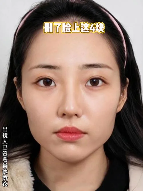 面部磨骨大概多少钱_1