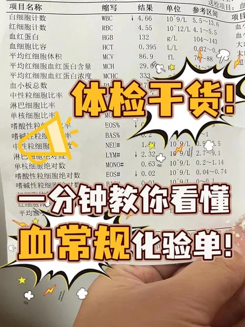 血常规包括什么检查项目-血常规检查项目详解
