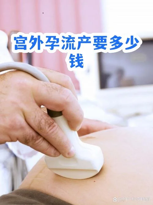 宫外孕大概多少钱_2