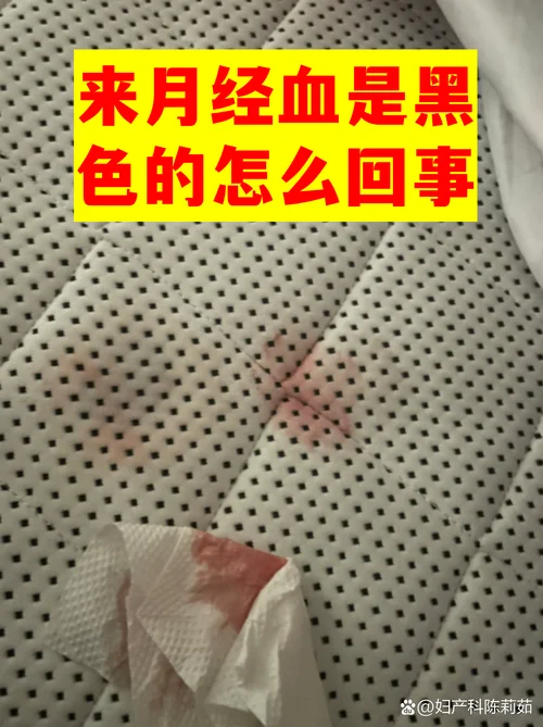 梦到自己来月经好多血_1