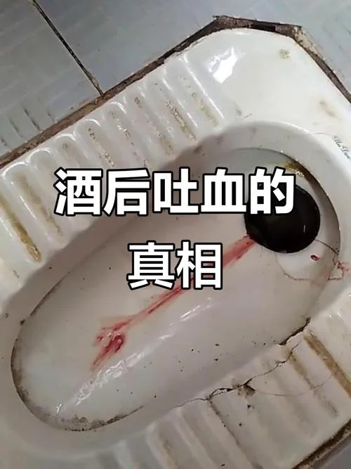 梦见男人吐血_2