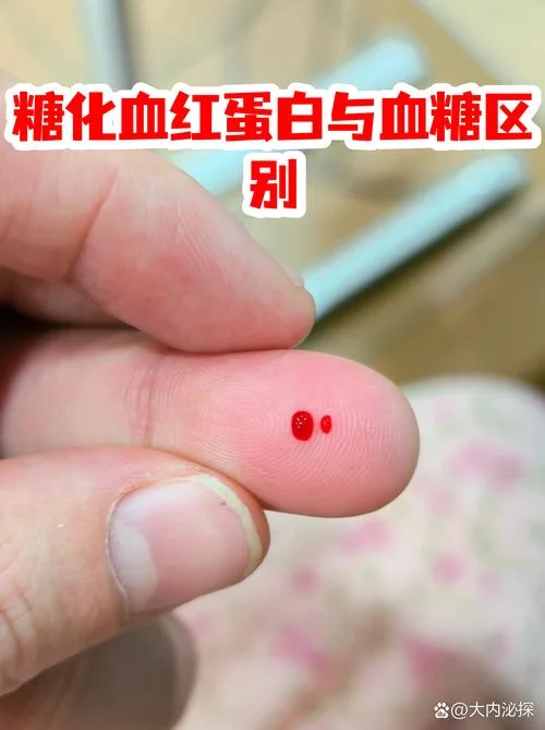 验糖化血红蛋白多少钱_1