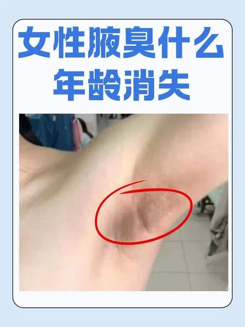 后腋臭怎么办_1