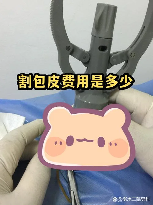 湖州割包皮多少钱_2