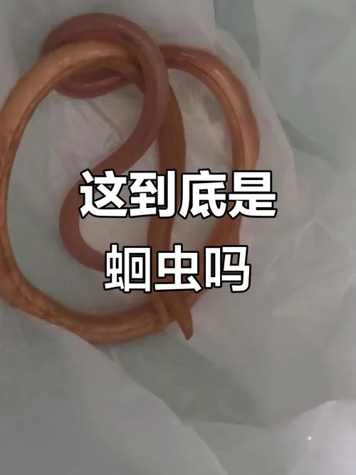 梦见蛔虫有什么预兆_1