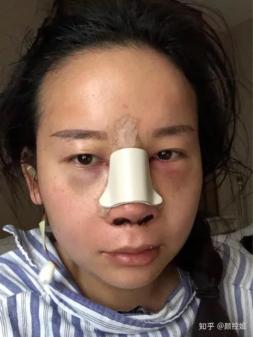 整容分期需要什么条件_2