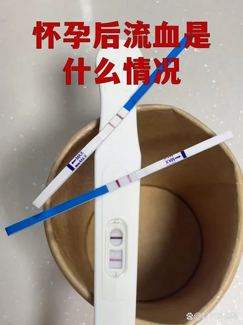 梦见怀孕流产出血_1