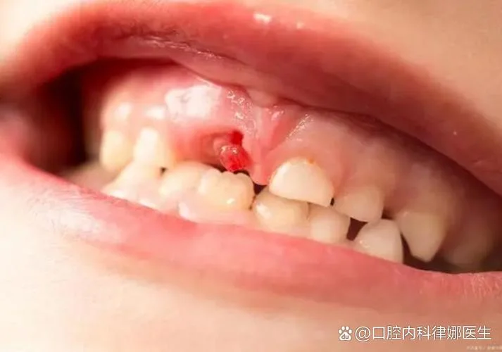 梦见牙掉流了好多血是什么意思_1